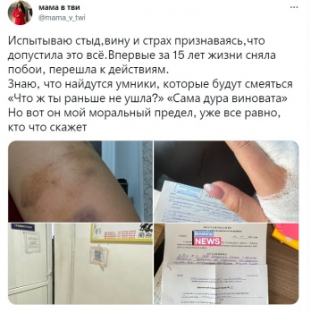 Инабат Латипова рассказала о семейном насилии длиной в 15 лет